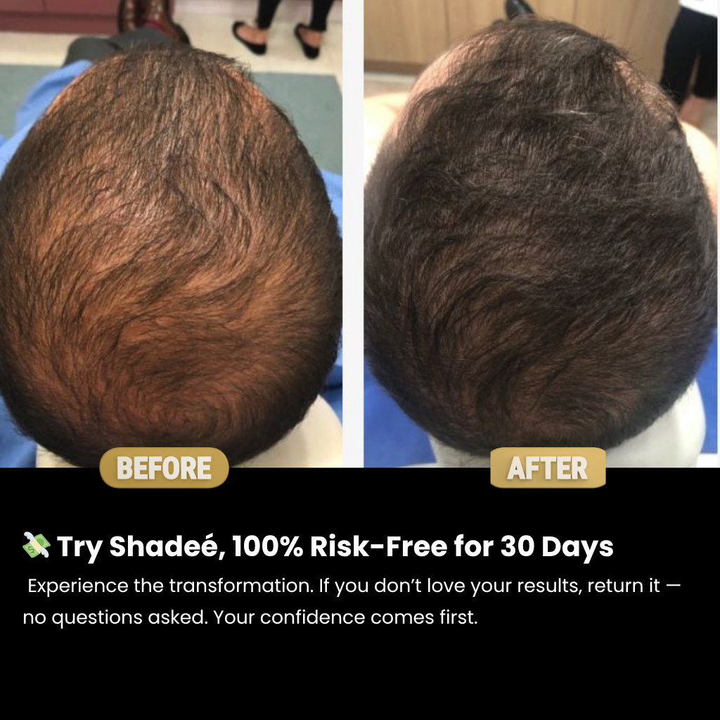 Shadeé Hairconcealer