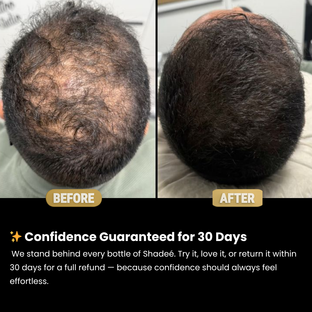 Shadeé Hairconcealer