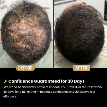 Shadeé Hairconcealer